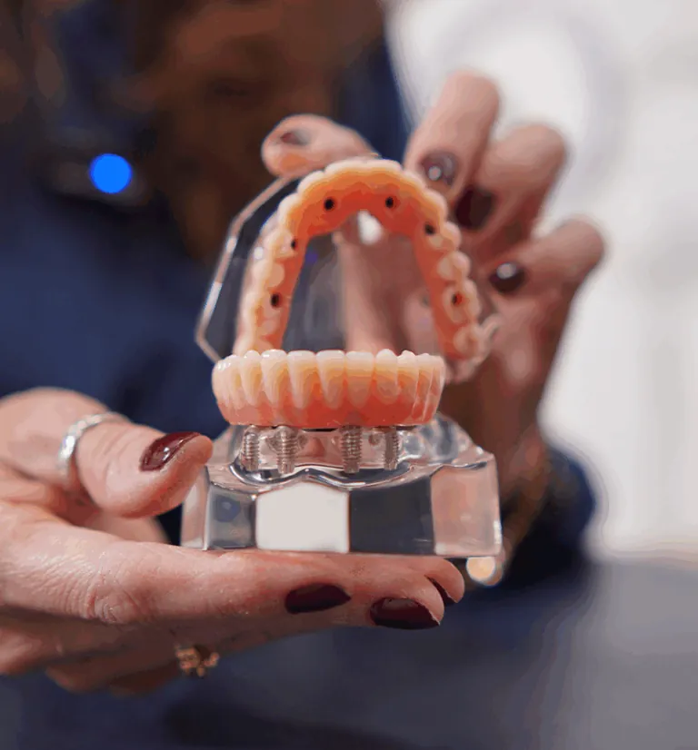 Ilustración del tratamiento: Prótesis dental